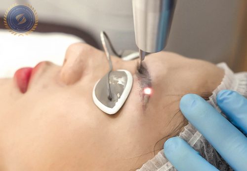 2. Học phun mày- Công nghệ Laser xóa xăm - hoidapnails.com