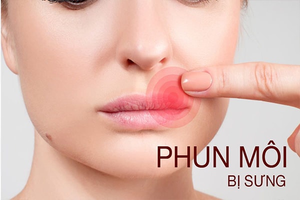 Phun môi có đau không webtretho - hoidapnails.com