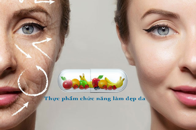 Thực phẩm chức năng làm đẹp 