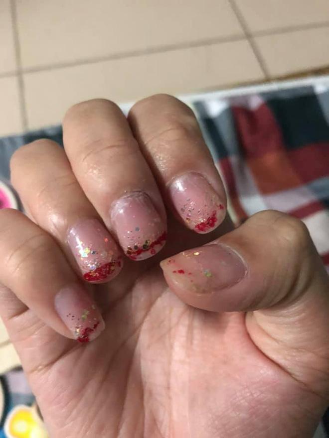 Làm nail bị xấu có sửa lại được không? Cách sửa nail bị làm xấu